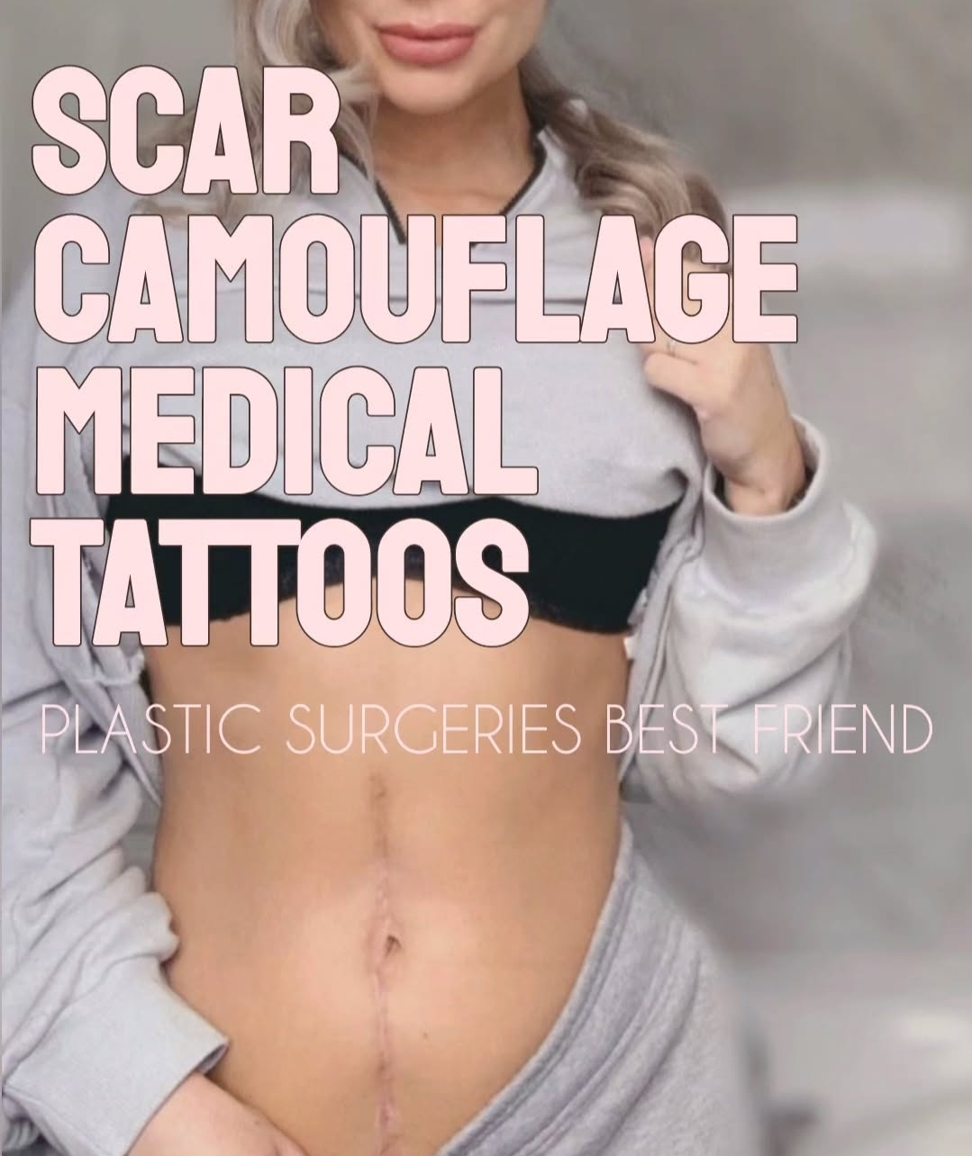 Writer: Scar Camouflage Medical Tattoo null